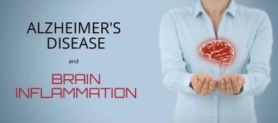 Alzheimer’s and Brain inflammation Alzheimer's Disease and Brain Inflammation