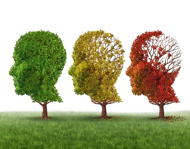 Memory loss due to dementia; treatments for dementia in Manhattan